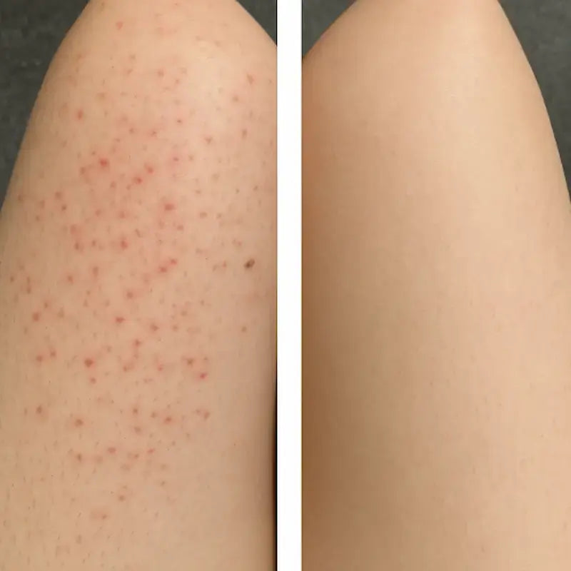 African Exfoliating Net